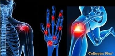 Prøv Collagen Plus gratis i 2 måneder