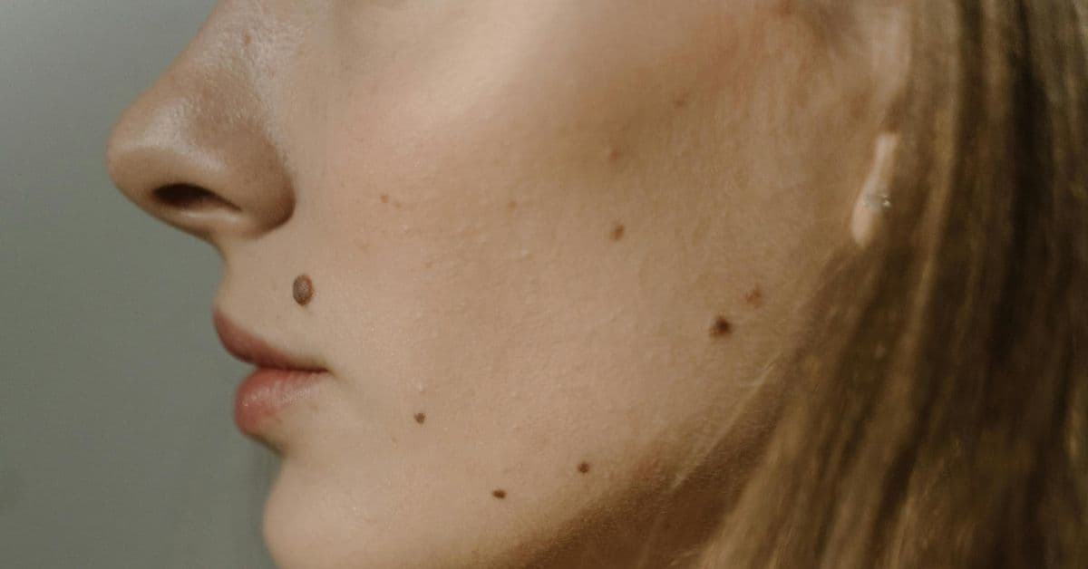 Gratis føflekksjekk i Oslo 15. og 16. mai - du får gratis solkremprøver